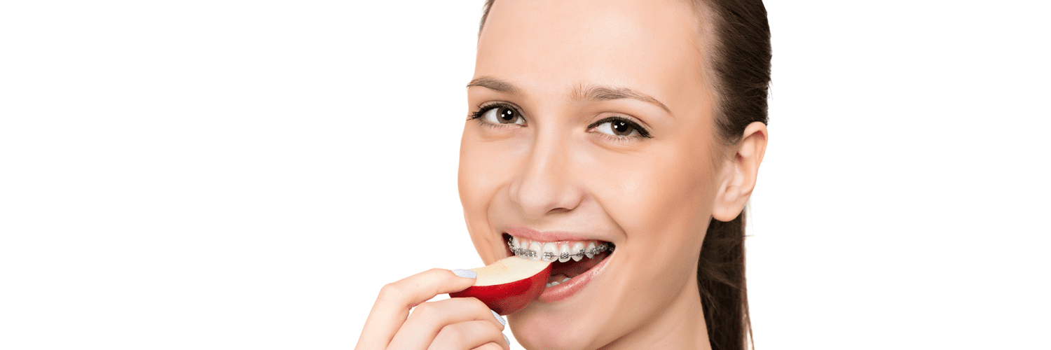 alimentos aparelho ortodôntico