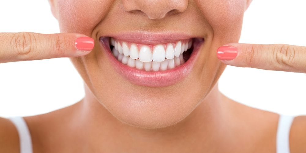 Clareamento dental