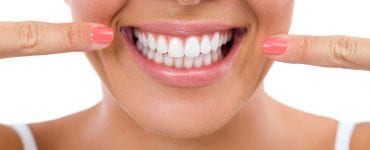 Clareamento dental