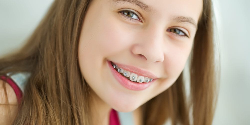 aparelho dental