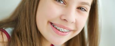 aparelho dental