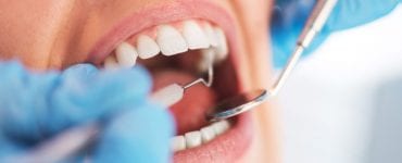 extração de um dente