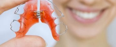 entortar após o uso do aparelho