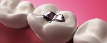 O que tomar para dor de dente