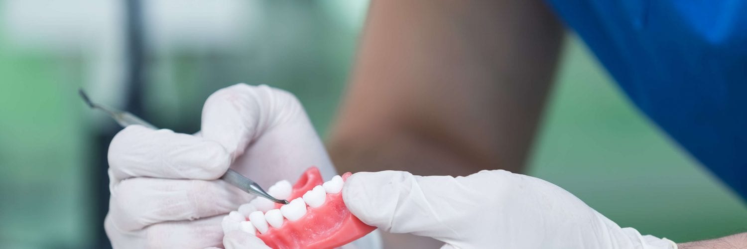 prótese dentária