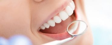Placa bacteriana: o que é e como se forma?