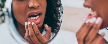 Dente cariado