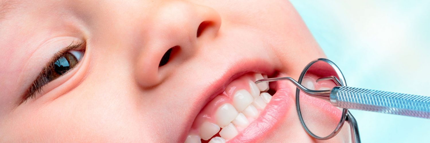 Cárie em dente de leite