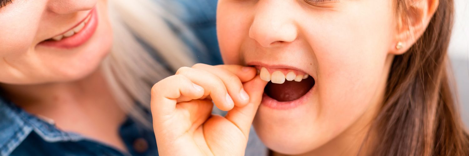 Como tirar dentes de leite
