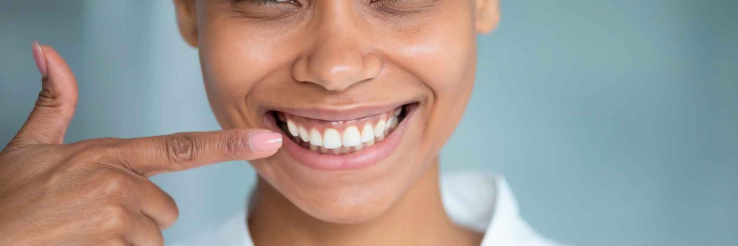 gengivoplastia recuperação