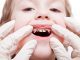 dente podre