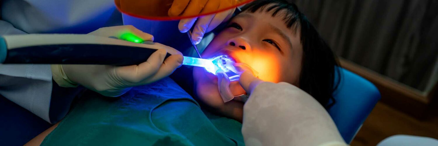 aplicação de flúor