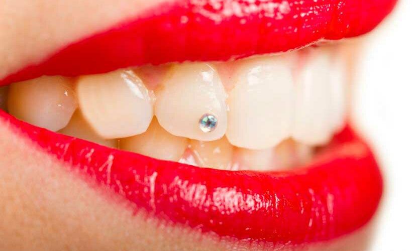 piercing no dente