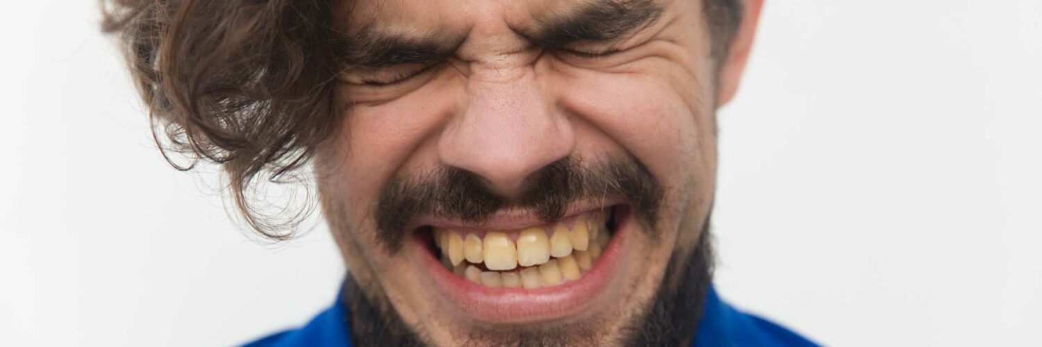 dentes feios