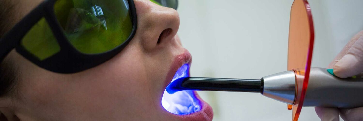 clareamento a laser