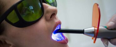 clareamento a laser