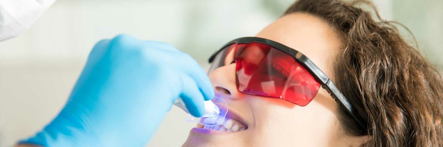 clareamento de dente desvitalizado