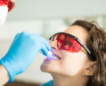 clareamento de dente desvitalizado