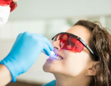 clareamento de dente desvitalizado
